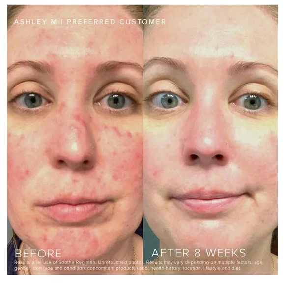 Rodan FieldsSoothe Daily Mineral Sunscreen/new in box / exp 12/2026 - Picture 4 of 10